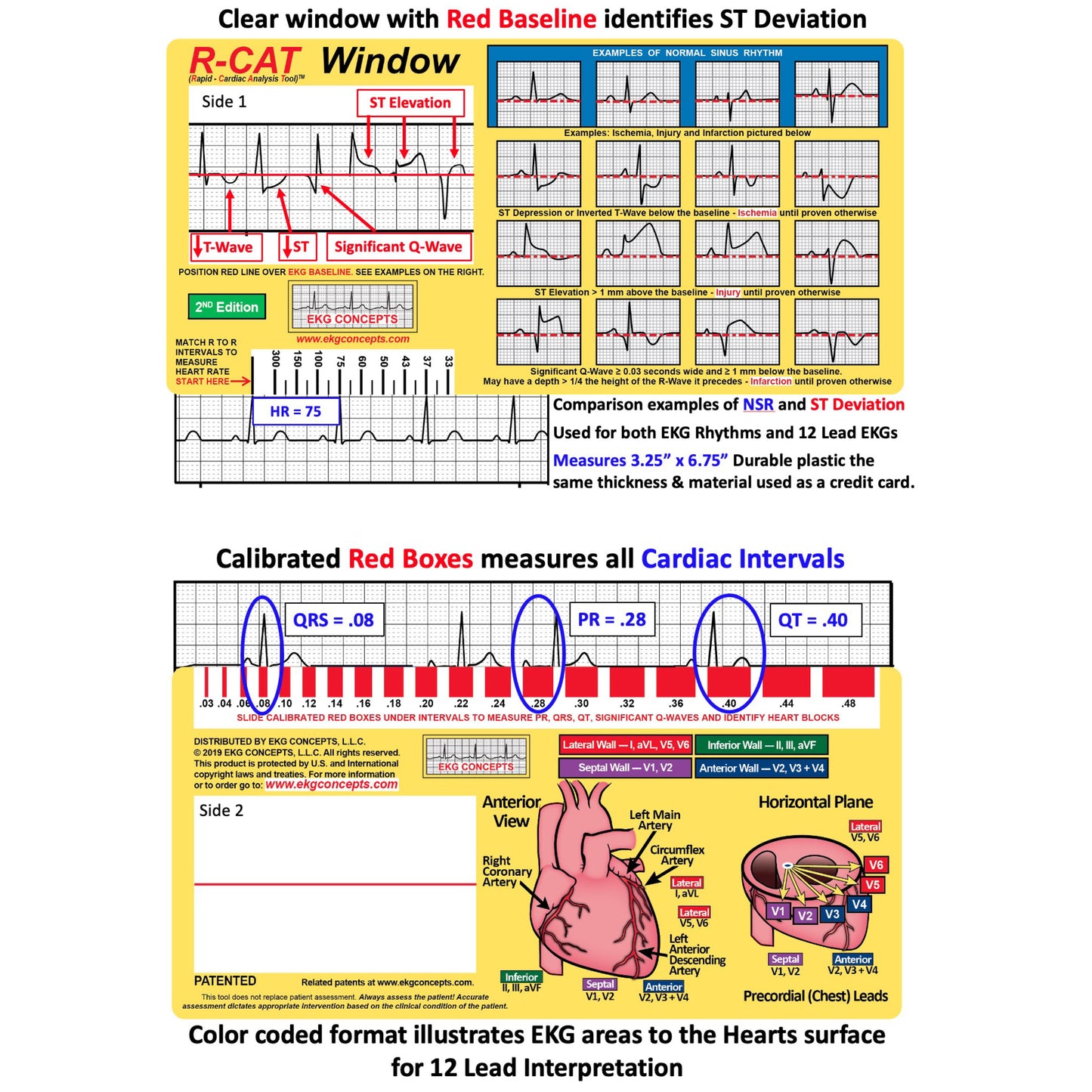 R-CAT Window - #3150