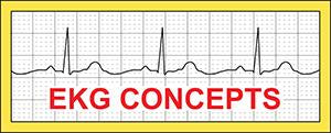 EKG Concepts | The R-CAT (Rapid Cardiac Analysis Tool) – EKG Concepts LLC