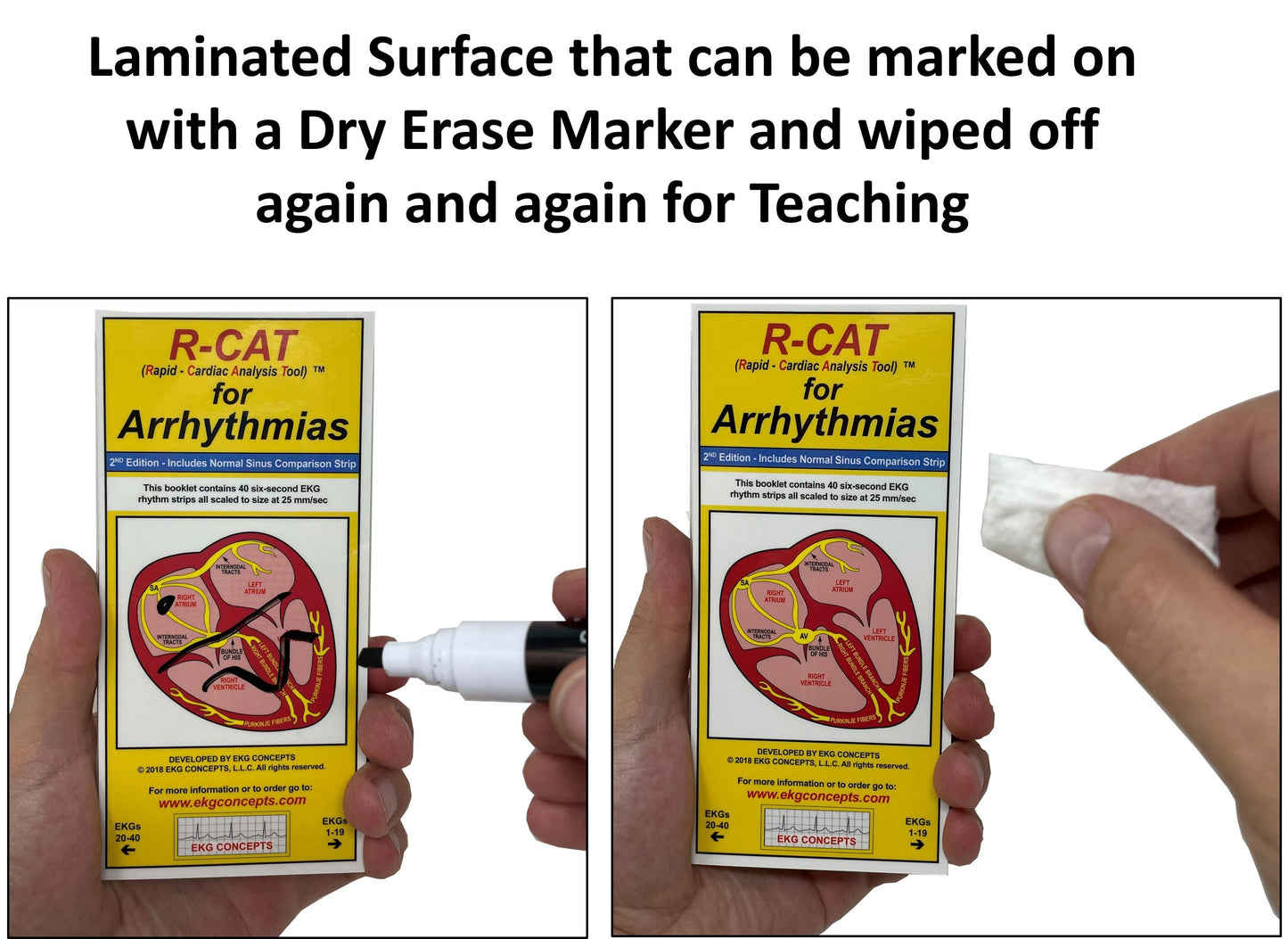 Pocket R-CAT for Arrhythmias - #3110