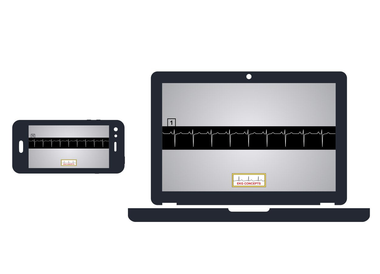 EKG Workbook Online Video Series 1