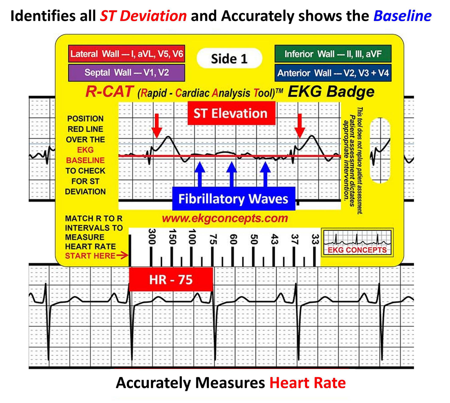 Pocket R-CAT for Arrhythmias + EKG Badge - #3250