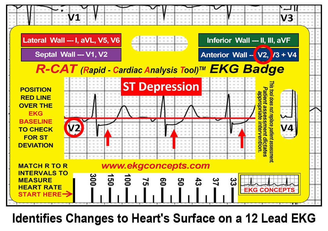 R-CAT EKG Badge - #3200