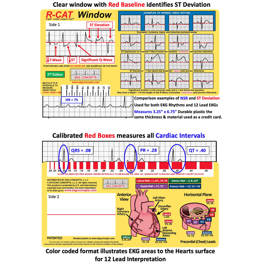 Top Cat R Value Ruler EKG Concepts | The R-CAT (Rapid Cardiac Analysis Tool) – EKG Concepts LLC